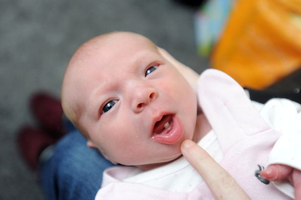 Con vừa mới sinh ra đời mẹ đã choáng váng không tin được khi thấy vật thể lạ lùng này trong miệng con - Ảnh 2. Con vừa mới sinh ra đời mẹ đã choáng váng không tin được khi thấy vật thể lạ lùng này trong miệng con - Ảnh 2.
