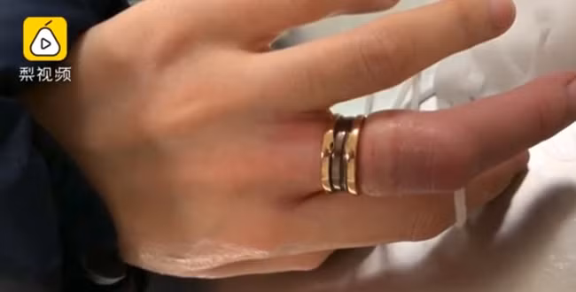 Cô gái đau khổ vì phải cắt chiếc nhẫn kỷ niệm do tăng cân, nhưng cách xử lý của bạn trai mới khiến mọi người chú ý - Ảnh 1.