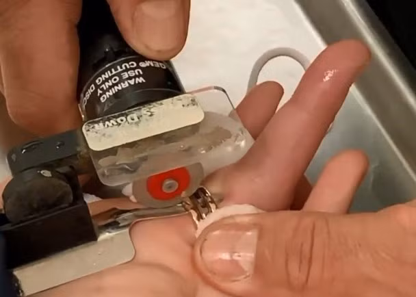 Cô gái đau khổ vì phải cắt chiếc nhẫn kỷ niệm do tăng cân, nhưng cách xử lý của bạn trai mới khiến mọi người chú ý - Ảnh 3.