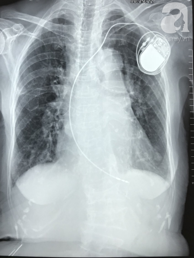 14 triệu người Việt bị bệnh này và con số đáng sợ: Cứ 4 người trưởng thành có 1 người mắc bệnh - Ảnh 4. 14 triệu người Việt bị bệnh này và con số đáng sợ: Cứ 4 người trưởng thành có 1 người mắc bệnh - Ảnh 4.