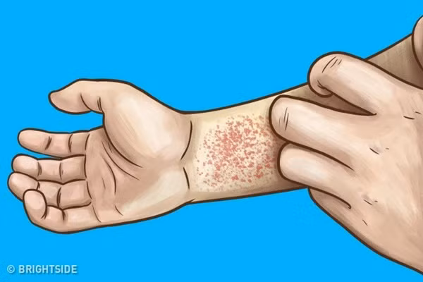 10 dấu hiệu cho thấy thận của bạn đang quá tải hoặc ngừng hoạt động-3