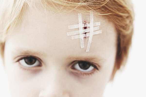 Trán bị xước là vận xui