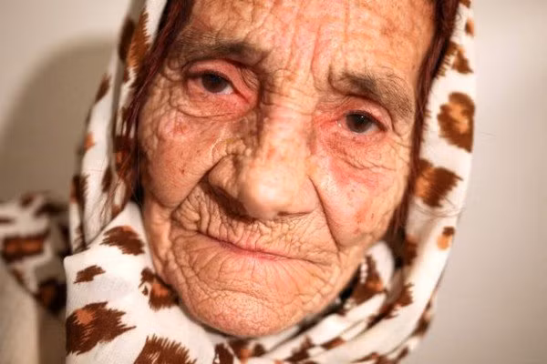  Bà Hava Celebic nói mình có thể làm sạch mắt với chiếc lưỡi của mình 