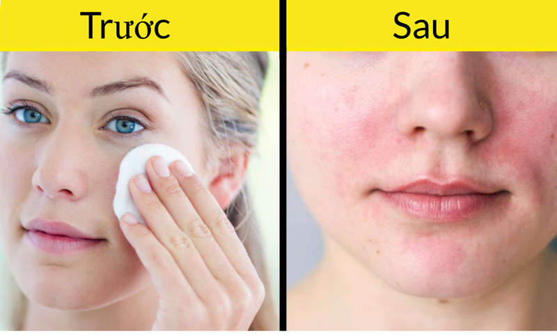 8 sai lầm khiến sản phẩm làm đẹp phản tác dụng hình 8 8 sai lam khien san pham lam dep phan tac dung hinh 8