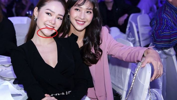 Chiếc cằm dài khiến nụ cười của Minh Hằng khá gượng gạo. Dáng vẻ đơ cứng của chiếc cằm từng vướng nghi án phẫu thuật thẩm mỹ. 