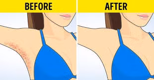 Sử dụng Vaseline để tránh trầy da trong những ngày hè.