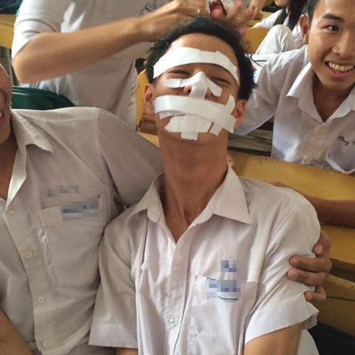 Dù biết bị băng rất xấu nhưng không thể lên tiếng được.