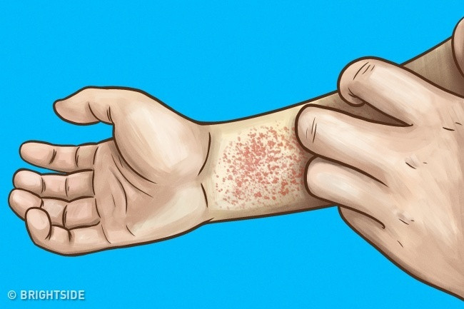 10 dấu hiệu chứng tỏ bạn mắc bệnh thận mà không hề hay biết