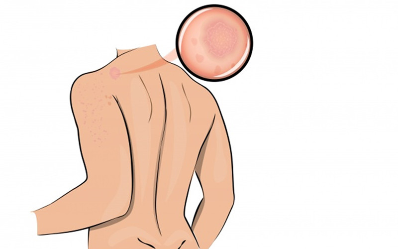 10 dấu hiệu quan trọng cảnh báo cơ thể bạn đang quá "stress" hình 1 10 dau hieu quan trong canh bao co the ban dang qua "stress" hinh 1