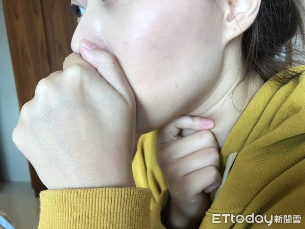 Cô gái chỉ sống được 5 ngày sau khi phát hiện ung thư: Dấu hiệu cảnh báo ai cũng phải chú ý ảnh 1 Cô gái 21 tuổi chỉ sống được 5 ngày sau khi phát hiện bị ung thư: Cảnh báo dấu hiệu ai cũng phải chú ý-1