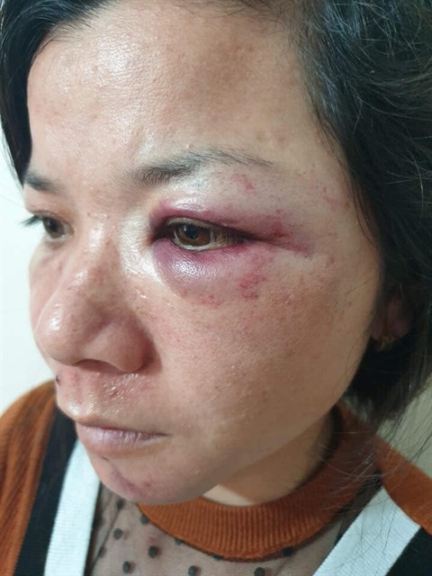 Tranh nhau ngủ với con, chồng đánh vợ thừa sống thiếu chết Tranh nhau ngu voi con, chong danh vo thua song thieu chet