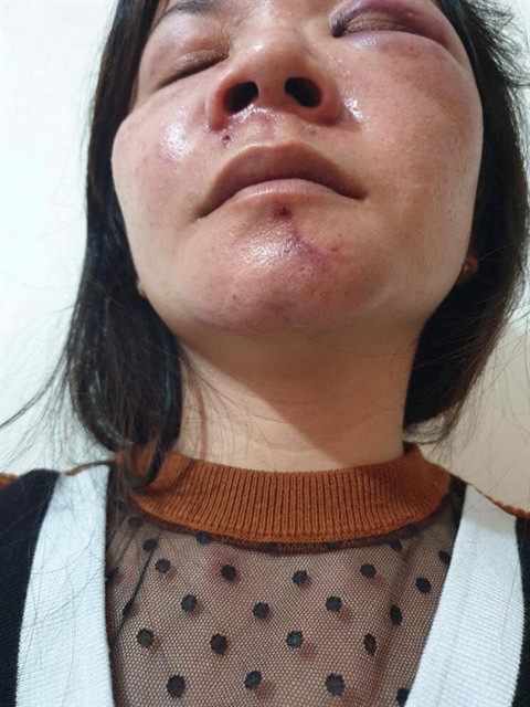 Tranh nhau ngủ với con, chồng đánh vợ thừa sống thiếu chết Tranh nhau ngu voi con, chong danh vo thua song thieu chet