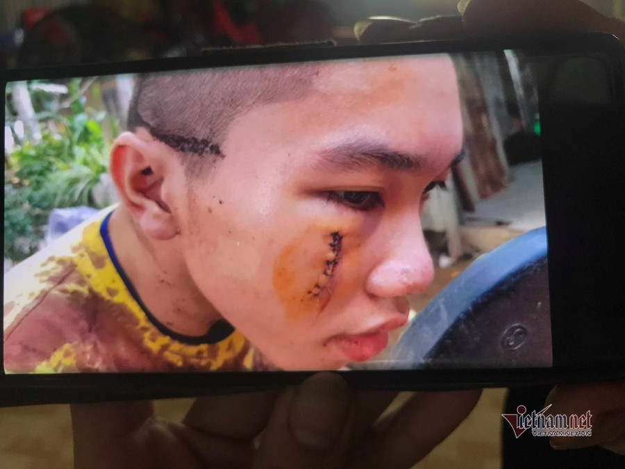 Diễn biến mới vụ 50 người đập phá nơi ở của 5 chú tiểu thi 