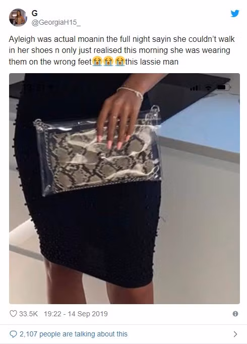 Cô gái trẻ liên tục than đau chân tại bữa tiệc, đến sáng mới nhận ra sai lầm của mình, khiến dân mạng "cười ra nước mắt" - Ảnh 1.