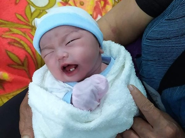 Em bé Bình Phước chào đời, bác sĩ nhìn vào miệng liền thốt lên đầy ngạc nhiên ảnh 1 em be binh phuoc chao doi, bac si nhin vao mieng lien thot len day ngac nhien - 1