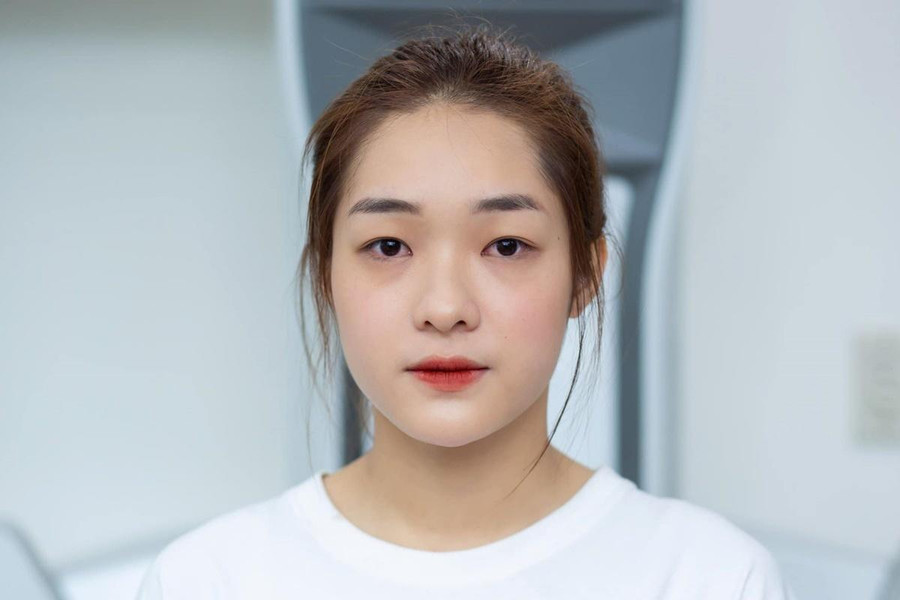 Nhan sắc của Hồng Hạnh trước khi phẫu thuật thẩm mỹ.