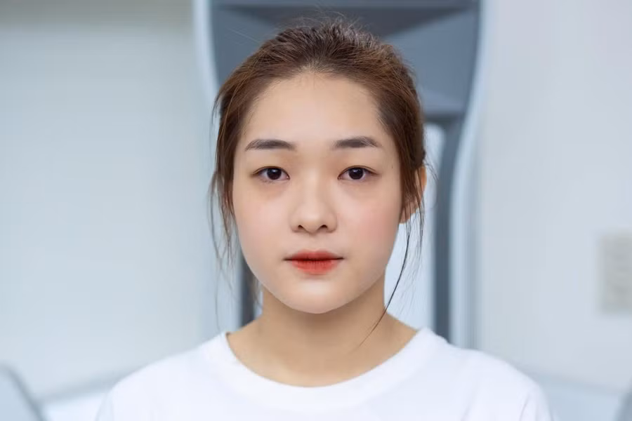 Nhan sắc của Hồng Hạnh trước khi phẫu thuật thẩm mỹ.