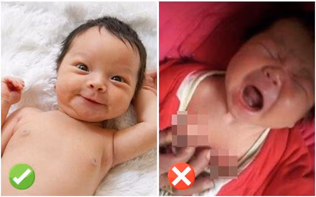 4 cách chăm sóc trẻ sơ sinh xưa cũ gây nguy hại, nhiều người vẫn tăm tắp làm theo ảnh 2 nhung quan niem cham soc tre so sinh xua cu gay nguy hai, bac si lac dau ngan ngam - 3