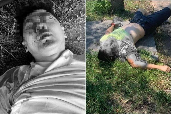 Cảnh tượng Lâm Chí Dĩnh sau tai nạn khiến người hâm mộ không khỏi xót xa.