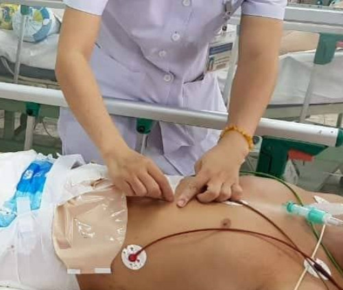 Báo động đỏ cứu bệnh nhân nguy cơ chết trên bàn mổ