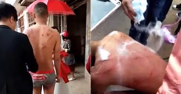 Chú rể bị đánh bầm giập và xát muối vào vết thương.