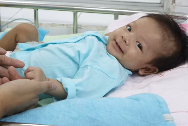 Bé gái khỏe mạnh sau phẫu thuật. Ảnh bệnh viện cung cấp.