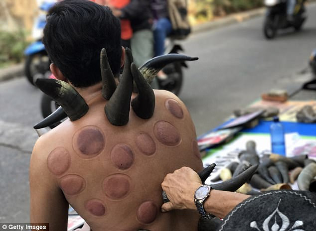 Phương pháp này đã được sử dụng hàng nghìn năm Phương pháp này đã được sử dụng hàng nghìn năm