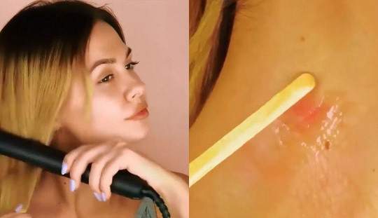 Giải cứu chị em khỏi những tai nạn lúc làm đẹp - Ảnh 2.