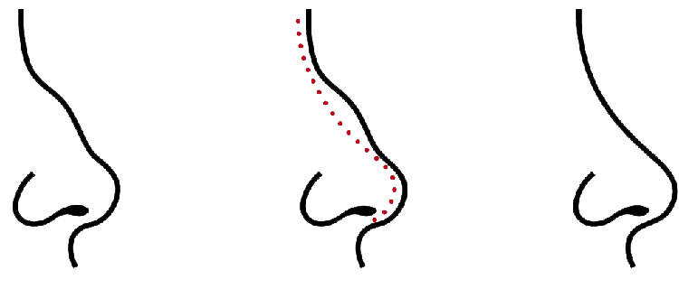 Your-nose-That-Reveal-Your-True-Intelligence Your-nose-That-Reveal-Your-True-Intelligence