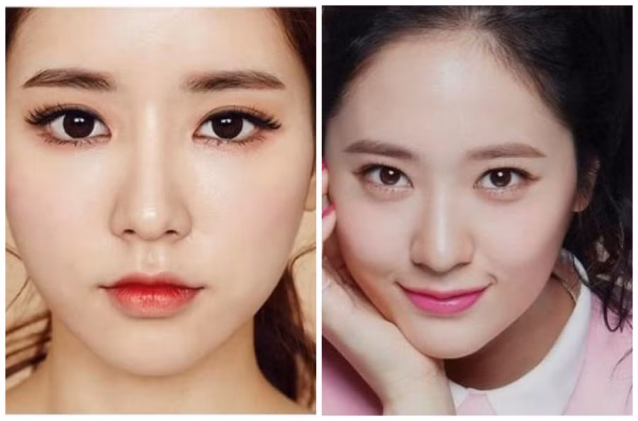 Mũi túi mật giàu có.