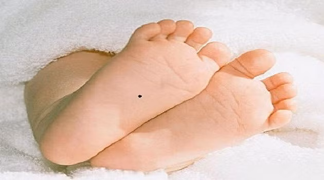 Nốt ruồi dưới lòng bàn chân.