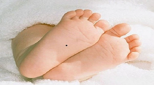 Nốt ruồi dưới lòng bàn chân.