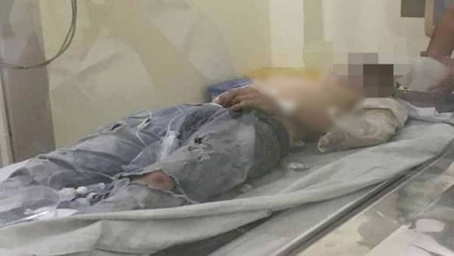 Nam nạn nhân đang được bác sĩ tích cực theo dõi, điều trị. Doi nam nu om nhau tu tu tren ghe da o lang dai hoc hinh anh 1
