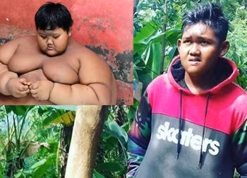 Quá trình giảm cân đáng kinh ngạc của cậu bé béo nhất thế giới