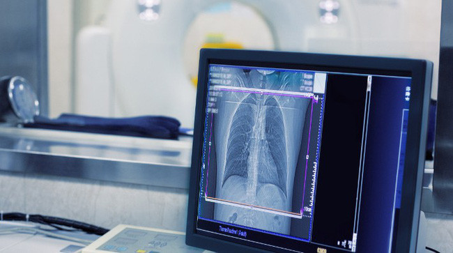 Cứ tưởng ho dai dẳng là bệnh nghề nghiệp, nữ giáo viên sốc khi biết nguyên nhân kinh khủng hơn nhiều - Ảnh 2. Cứ tưởng ho dai dẳng là bệnh nghề nghiệp, nữ giáo viên sốc khi biết nguyên nhân kinh khủng hơn nhiều - Ảnh 2.