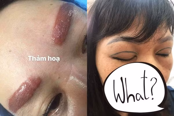 Hình ảnh đôi lông mày và mí khiến mọi người hoảng sợ.