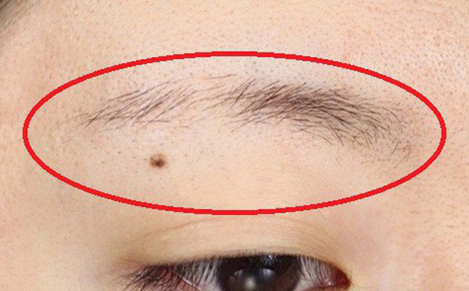 Lông mày có 6 dấu hiệu này bạn cần đến gặp bác sĩ nhanh còn kịp