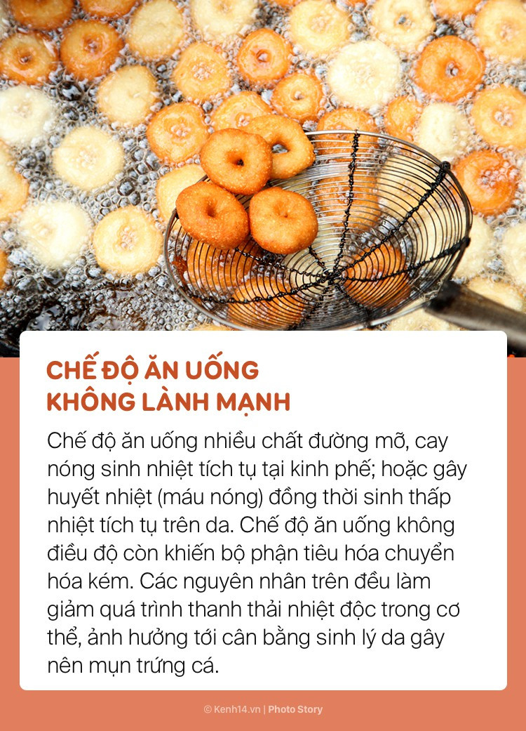 Mụn mọc đầy lưng thì hãy chú ý xem bạn có mắc những sai lầm này - Ảnh 11. Mụn mọc đầy lưng thì hãy chú ý xem bạn có mắc những sai lầm này - Ảnh 11.