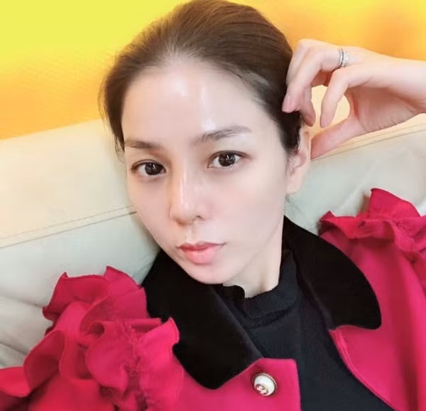 Lệ Quyên tháo sụn mũi giả tránh hoại tử