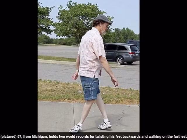 Kỷ lục thế giới: Xoay bàn chân 180 độ ra sau và đi lại dễ dàng - Hình 1