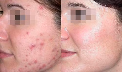 gia nat rau diep ca roi cho them thu nay, mun cung dau den dau cung het sach den do - 5