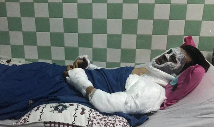 Việt kiều bị tạt axit ngày Tết: Đôi mắt bị tổn thương nặng hình ảnh 1  Viet kieu bi tat axit ngay Tet: Doi mat bi ton thuong nang hinh anh 1