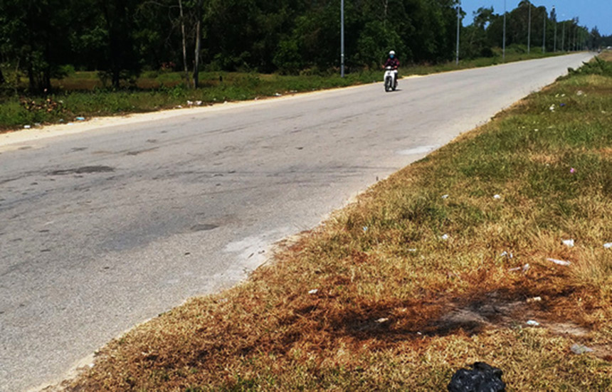 Việt kiều bị tạt axit ngày Tết: Đôi mắt bị tổn thương nặng hình ảnh 2  Viet kieu bi tat axit ngay Tet: Doi mat bi ton thuong nang hinh anh 2