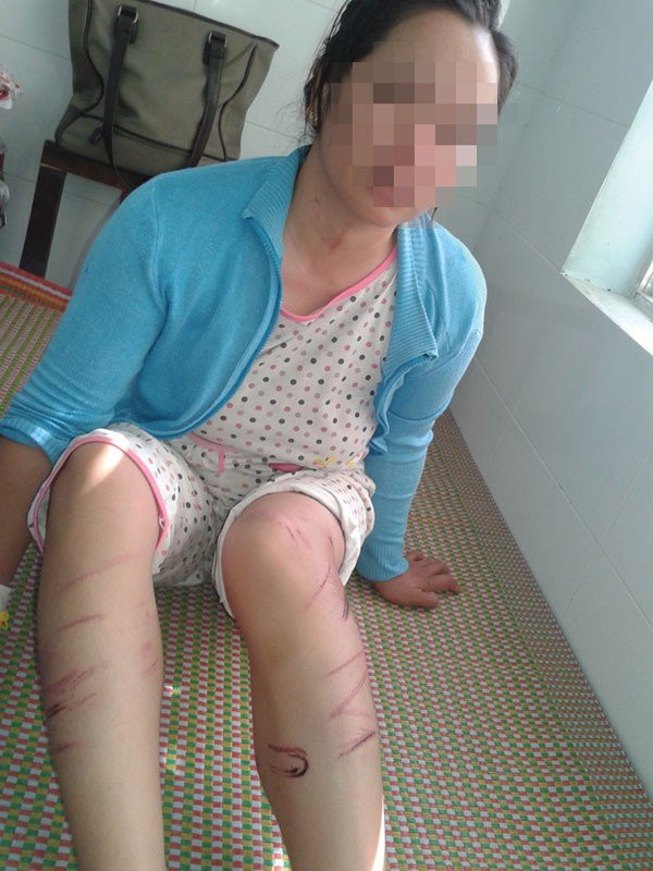 đánh vợ, bạo hành đánh vợ, bạo hành