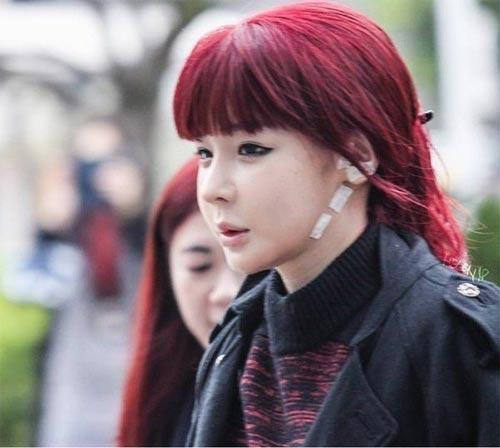 Giật mình với khuôn mặt sưng phồng, méo mó của Park Bom ảnh 9 Giật mình với khuôn mặt sưng phồng, méo mó của Park Bom ảnh 9