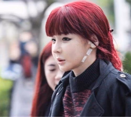 Giật mình với khuôn mặt sưng phồng, méo mó của Park Bom ảnh 9