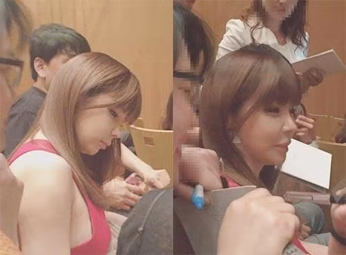 Giật mình với khuôn mặt sưng phồng, méo mó của Park Bom