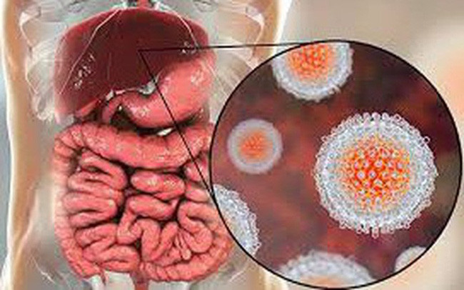 Những căn bệnh lây truyền qua đường ăn uống thường gặp được bác sĩ cảnh báo - Ảnh 3. Những căn bệnh lây truyền qua đường ăn uống thường gặp được bác sĩ cảnh báo - Ảnh 3.