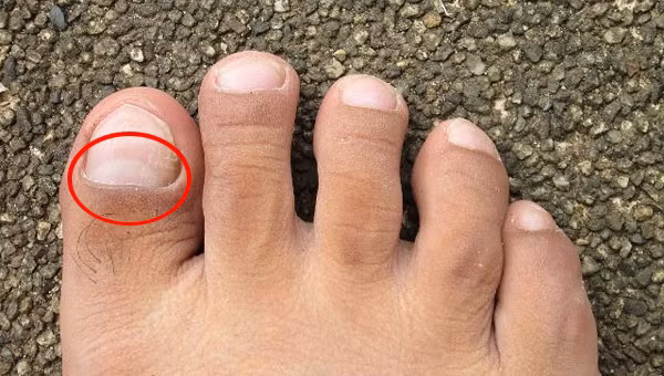 Hình bán nguyệt trên móng chân chúng ta cũng có thể phản ánh tình trạng sức khỏe cơ thể.