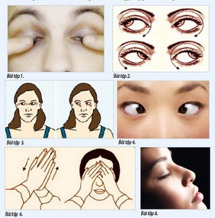 Người bệnh đột quỵ cần luyện những bài tập tốt cho mắt.